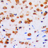 AKT1 Antibody - Immunohistochemical analysis of AKT staining in human brain formalin fixed paraffin embedded tissue section. The section was pre-treated using heat mediated antigen retrieval with sodium citrate buffer (pH 6.0). The section was then incubated with the antibody at room temperature and detected using an HRP conjugated compact polymer system. DAB was used as the chromogen. The section was then counterstained with hematoxylin and mounted with DPX.