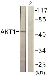 AKT1 Antibody - Western blot analysis of extracts from HuvEc cells, treated with Serum (30%, 30mins), using Akt (Ab-129) antibody.