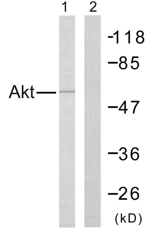 AKT1 Antibody - Western blot analysis of the extracts from Jurkat cells using Akt (Ab-308) antibody.