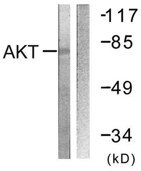 AKT1 Antibody - Western blot analysis of extracts from NIH/3T3 cells, treated with Insulin (0.01U/ml, 15mins), using Akt (Ab-326) antibody.