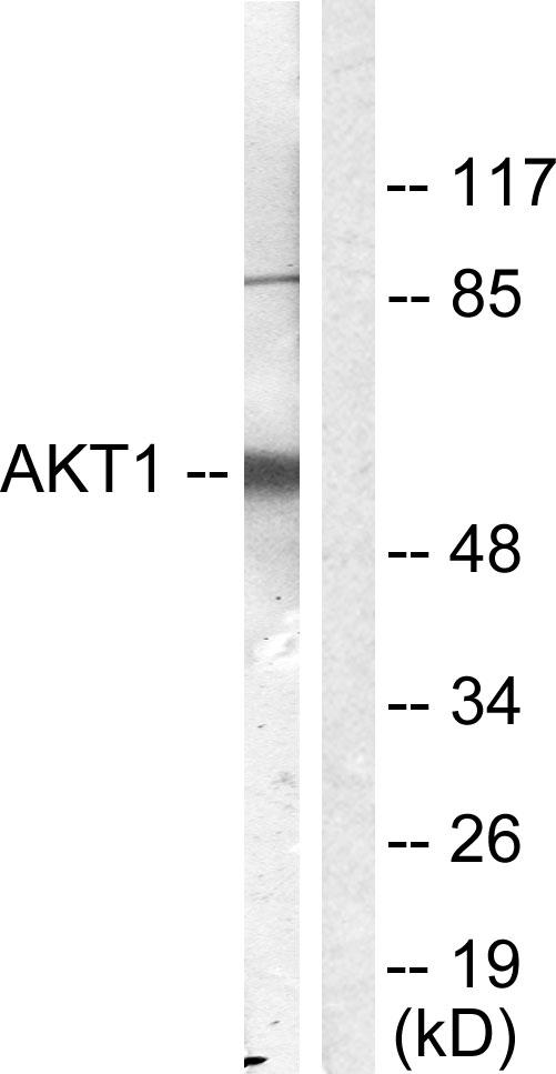 AKT1 Antibody - Western blot analysis of extracts from NIH/3T3 cells, treated with Serum (10%, 30mins), using Akt (Ab-450) antibody.