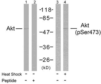 AKT1 Antibody - Western blot analysis of extracts from HeLa cells treated or untreated with heat shock using Akt (Ab-473) Antibody and Akt (Phospho-Ser473) Antibody. Line2: Using preincubated with synthesized peptide.