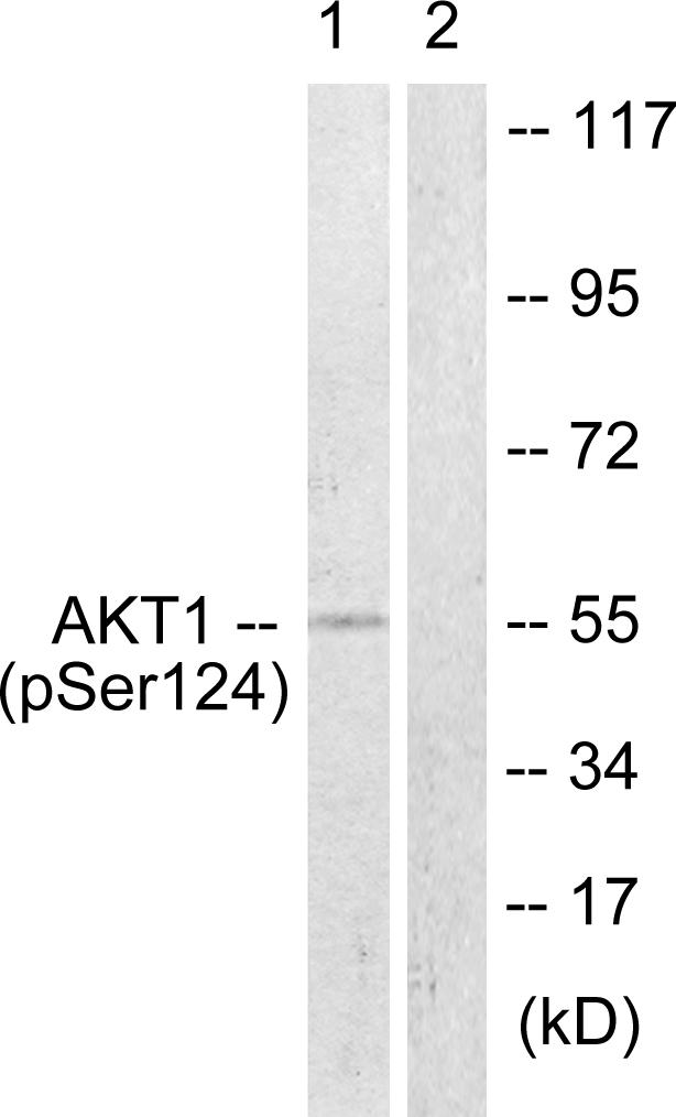 AKT1 Antibody - Western blot analysis of lysates from mouse brain, using Akt (Phospho-Ser124) Antibody. The lane on the right is blocked with the phospho peptide.