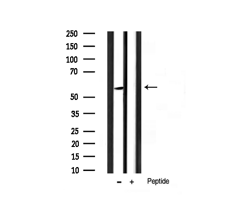 AKT1 Antibody - Western blot analysis of Akt phosphorylation expression in B2C cells line lysates. The lane on the right is treated with the antigen-specific peptide.