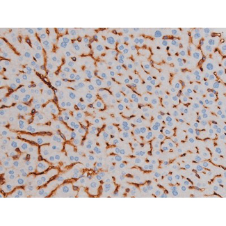 AKT1 Antibody - 1:200 staining mouse liver tissue by IHC-P. The tissue was formaldehyde fixed and a heat mediated antigen retrieval step in citrate buffer was performed. The tissue was then blocked and incubated with the antibody for 1.5 hours at 22°C. An HRP conjugated goat anti-rabbit antibody was used as the secondary.