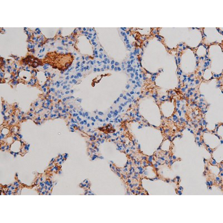 AKT1 Antibody - 1:200 staining mouse lung tissue by IHC-P. The tissue was formaldehyde fixed and a heat mediated antigen retrieval step in citrate buffer was performed. The tissue was then blocked and incubated with the antibody for 1.5 hours at 22°C. An HRP conjugated goat anti-rabbit antibody was used as the secondary.
