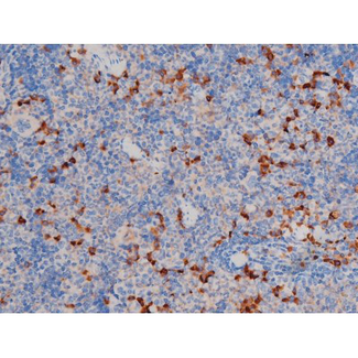 AKT1 Antibody - 1:200 staining mouse spleen tissue by IHC-P. The tissue was formaldehyde fixed and a heat mediated antigen retrieval step in citrate buffer was performed. The tissue was then blocked and incubated with the antibody for 1.5 hours at 22°C. An HRP conjugated goat anti-rabbit antibody was used as the secondary.