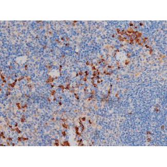 AKT1 Antibody - 1:200 staining mouse spleen tissue by IHC-P. The tissue was formaldehyde fixed and a heat mediated antigen retrieval step in citrate buffer was performed. The tissue was then blocked and incubated with the antibody for 1.5 hours at 22°C. An HRP conjugated goat anti-rabbit antibody was used as the secondary.