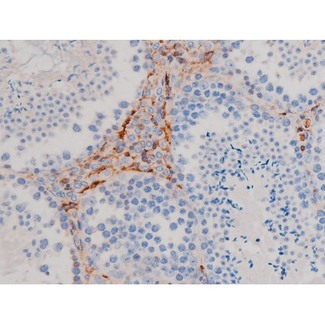 AKT1 Antibody - 1:200 staining mouse testis tissue by IHC-P. The tissue was formaldehyde fixed and a heat mediated antigen retrieval step in citrate buffer was performed. The tissue was then blocked and incubated with the antibody for 1.5 hours at 22°C. An HRP conjugated goat anti-rabbit antibody was used as the secondary.