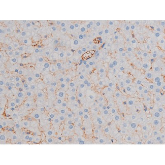 AKT1 Antibody - 1:200 staining rat liver tissue by IHC-P. The tissue was formaldehyde fixed and a heat mediated antigen retrieval step in citrate buffer was performed. The tissue was then blocked and incubated with the antibody for 1.5 hours at 22°C. An HRP conjugated goat anti-rabbit antibody was used as the secondary.