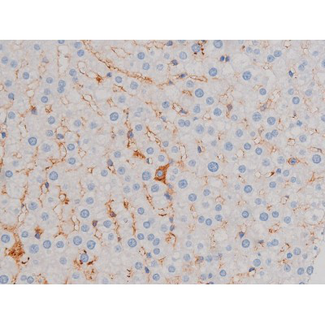 AKT1 Antibody - 1:200 staining rat liver tissue by IHC-P. The tissue was formaldehyde fixed and a heat mediated antigen retrieval step in citrate buffer was performed. The tissue was then blocked and incubated with the antibody for 1.5 hours at 22°C. An HRP conjugated goat anti-rabbit antibody was used as the secondary.