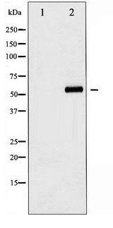 AKT1 Antibody - Western blot of Akt phosphorylation expression in PMA treated A549 whole cell lysates,The lane on the left is treated with the antigen-specific peptide.
