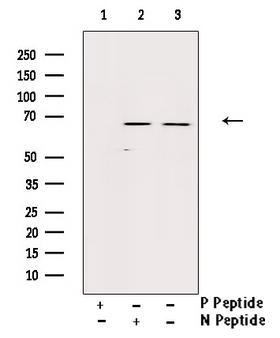 AKT1 Antibody - Western blot analysis of Phospho-Akt (Ser129) antibody expression in PMA treated A549 cells lysates. The lane on the right is treated with the antigen-specific peptide.