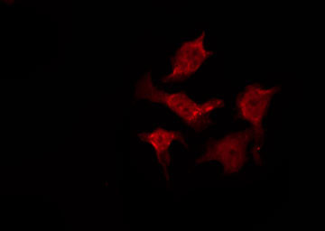 AKT1 Antibody - Staining 293 cells by IF/ICC. The samples were fixed with PFA and permeabilized in 0.1% Triton X-100, then blocked in 10% serum for 45 min at 25°C. The primary antibody was diluted at 1:200 and incubated with the sample for 1 hour at 37°C. An Alexa Fluor 594 conjugated goat anti-rabbit IgG (H+L) Ab, diluted at 1/600, was used as the secondary antibody.