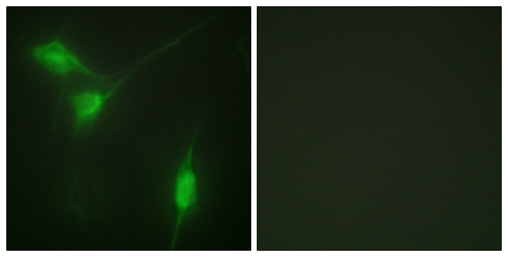 AKT1 Antibody - Immunofluorescence analysis of NIH/3T3 cells, using Akt (Phospho-Ser246) Antibody. The picture on the right is blocked with the phospho peptide.