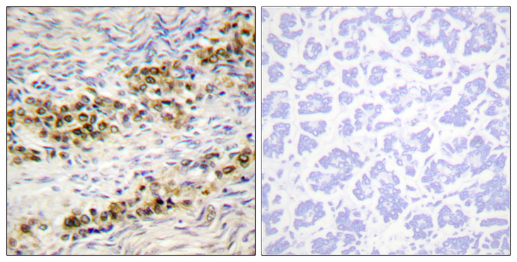 AKT1 Antibody - Immunohistochemistry analysis of paraffin-embedded human ovary, using Akt (Phospho-Ser246) Antibody. The picture on the right is blocked with the phospho peptide.