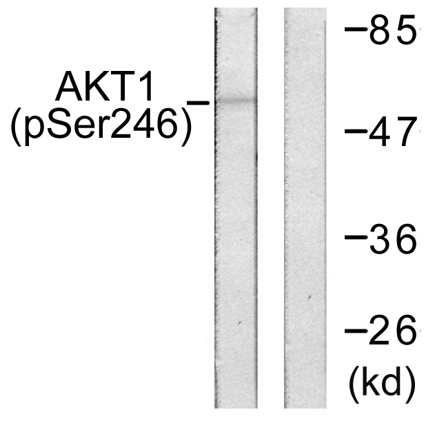 AKT1 Antibody - Western blot analysis of lysates from HeLa cells treated with Etoposide 25uM 24h, using Akt (Phospho-Ser246) Antibody. The lane on the right is blocked with the phospho peptide.