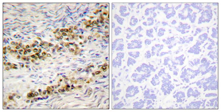 AKT1 Antibody - P-peptide - + Immunohistochemistry analysis of paraffin-embedded human ovary tissue using Akt (Phospho-Ser246) antibody.
