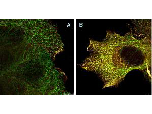 AKT1 Antibody - Immunofluorescence Microscopy of Mouse Anti-AKTpS473 antibody using STED nanoscopy to evaluate AKT activation and migration. Tissue: A431 cells. Antigen retrieval: Panel A: serum starved,unstimulated cells. Panel B: serum starved, EGF stimulated for 15 mins. A massive increase in AKT-pS473 activation, as measured by intensity signal, peaked at 15 minutes and was associated with depolymerized tubulin. Staining: Panel A shows STED data (AKT-pS473, red channel) collected simultaneously with confocal signal (a-tubulin, green channel). Upon stimulation of cells with EGF, a rapid activation of AKT is observed (Panel B) along with a coincident change in the tubulin organization (yellow signal), as well as an extensive cell shape-change (cell membrane folding) and accumulation of AKTpS473 at the cell periphery.