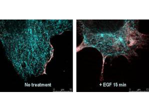AKT1 Antibody - Immunofluorescence confocal microscopy of Mouse Anti-AKT pS473 antibody. Tissue: EGF treated A431 cells. Fixation: 0.5% PFA. Antigen retrieval: EGF 15 min. Primary antibody: AKT pS473 antibody at 10 µg/mL for 1 h at RT. Secondary antibody: DyLight 488 Goat anti-Rabbit IgG, MAb anti-AKT pS473, atto-647N anti-Mouse IgG (Active Motif). at 1:10,000 for 45 min at RT. Localization: AKT pS473 is nuclear and occasionally cytoplasmic. Staining: AKT pS473 as red signal with tubulin (cyan).