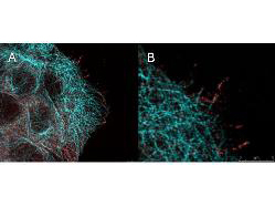 AKT1 Antibody - High resolution STED immunofluorescence nanoscopy of Mouse anti-AKT pS473 antibody. Tissue: A431 cells. The merge images (A) and at high magnification (B) show phosphorylated AKT colocalized with the distal microtubules. Fixation: 4% paraformaldehyde for 5 min and after washes blocked with 10% NGS/0.2% Triton X-100 for 30 min. Antigen retrieval: serum deprivation for 12 h. Primary antibody: AKT pS473 antibody at 10 µg/mL and a-tubulin (cyan) at 1.4 µg/mL for 1 h at RT. Secondary antibody: Atto 647N anti-Mouse IgG (ATTO TEC GmbH), and DyLight 488 anti-Rabbit IgG were used at 1.0 µg/mL for 1h at RT for indirect detection. Localization: AKT pS473 is in the cytoplasm and also organized at the periphery of the cell. Staining: AKT pS473 as red signal with bis-benzimide (blue) nuclear counterstain.