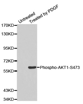 AKT1 Antibody - Western blot analysis of extracts from NIH/3T3.