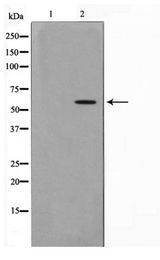 AKT1 Antibody - Western blot of Akt phosphorylation expression in heatshock treated HeLa whole cell lysates,The lane on the left is treated with the antigen-specific peptide.