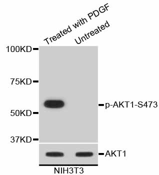 AKT1 Antibody - Western blot analysis of extracts of various cells.