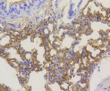AKT1 Antibody - Immunohistochemistry of paraffin-embedded mouse lung tissue.