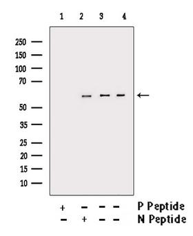 AKT1 Antibody - Western blot analysis of Phospho-Akt(Ser473) antibody expression in Various cells lysates.