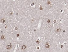 AKT1 Antibody - Phospho-Akt(Ser473) antibody for IHC in human brain tissue