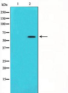AKT1 Antibody - Western blot analysis on 293 cell lysates using Phospho-Akt(Ser473) antibody. The lane on the left is treated with the antigen-specific peptide.