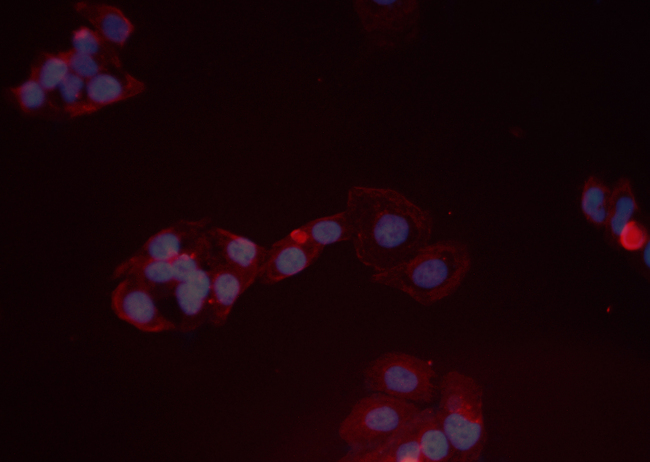 AKT1 Antibody - Staining 293 cells by IF/ICC. The samples were fixed with PFA and permeabilized in 0.1% Triton X-100, then blocked in 10% serum for 45 min at 25°C. The primary antibody was diluted at 1:200 and incubated with the sample for 1 hour at 37°C. An Alexa Fluor 594 conjugated goat anti-rabbit IgG (H+L) Ab, diluted at 1/600, was used as the secondary antibody.