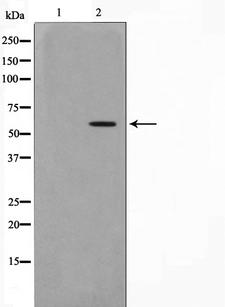 AKT1 Antibody - Western blot analysis of Akt phosphorylation expression in heatshock treated HeLa whole cells lysates. The lane on the left is treated with the antigen-specific peptide.