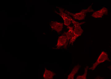 AKT1 Antibody - Staining HeLa cells by IF/ICC. The samples were fixed with PFA and permeabilized in 0.1% Triton X-100, then blocked in 10% serum for 45 min at 25°C. The primary antibody was diluted at 1:200 and incubated with the sample for 1 hour at 37°C. An Alexa Fluor 594 conjugated goat anti-rabbit IgG (H+L) Ab, diluted at 1/600, was used as the secondary antibody.