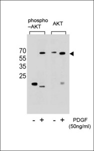 AKT1 Antibody - Western blot of extracts from NIH-3T3 cells,untreated or treated with PDGF,using Phospho-Akt(Ser473)(left) or Akt antibody(right).