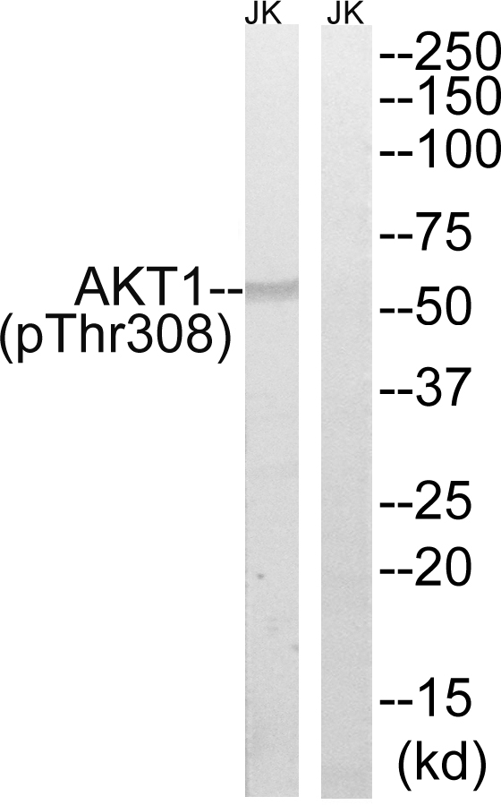 AKT1 Antibody - Western blot analysis of lysates from Jurkat cells treated with EGF 200ng/ml 5', using AKT1 (Phospho-Thr308) Antibody. The lane on the right is blocked with the phospho peptide.