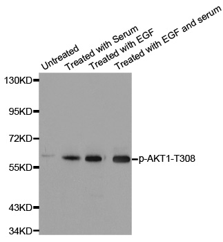 AKT1 Antibody - Western blot analysis of extracts from HeLa cells.