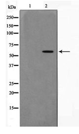 AKT1 Antibody - Western blot of 293 cell lysate using Phospho-AKT1(Thr308) Antibody