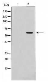 AKT1 Antibody - Western blot of Akt phosphorylation expression in Insulin treated 293 whole cell lysates,The lane on the left is treated with the antigen-specific peptide.
