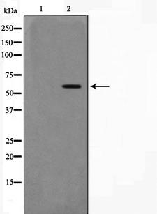 AKT1 Antibody - Western blot analysis on 293 cell lysates using Phospho-AKT1(Thr308) antibody. The lane on the left is treated with the antigen-specific peptide.