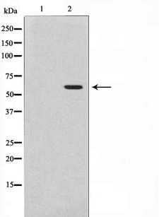 AKT1 Antibody - Western blot analysis of Akt phosphorylation expression in Insulin treated 293 whole cells lysates. The lane on the left is treated with the antigen-specific peptide.