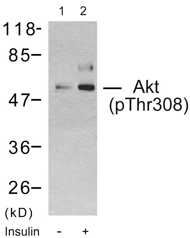 AKT1 Antibody - Western blot analysis using Akt(Phospho-Thr308) Antibody: Line1: The extracts from 293 cells untreated; Line2: The extracts from 293 cells treated with insulin.