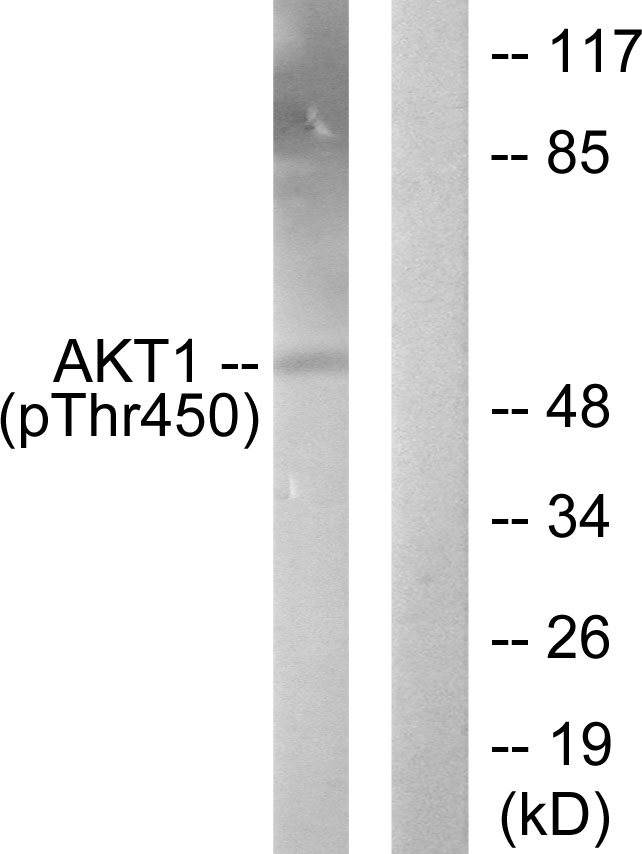 AKT1 Antibody - Western blot analysis of lysates from NIH/3T3 cells treated with PDGF 50ng/ml 20', using Akt1 (Phospho-Thr450) Antibody. The lane on the right is blocked with the phospho peptide.