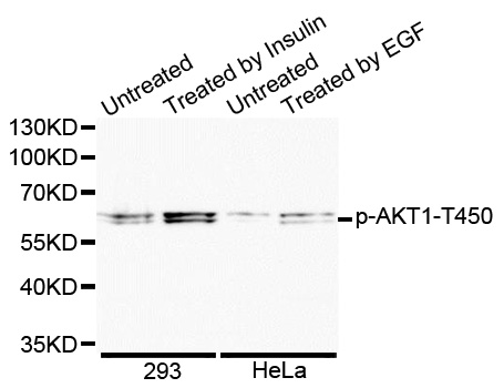AKT1 Antibody - Western blot analysis of extracts of various cell lines.