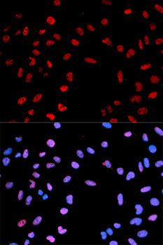 AKT1 Antibody - Immunofluorescence analysis of MCF7 cells.