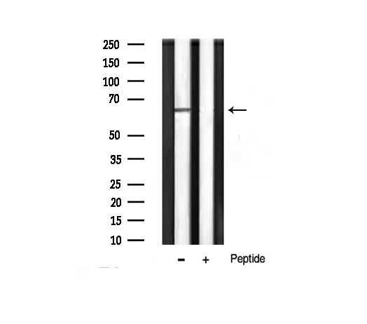 AKT1 Antibody - Western blot analysis of Akt1 phosphorylation expression in B2C whole cells lysates. The lane on the right is treated with the antigen-specific peptide.