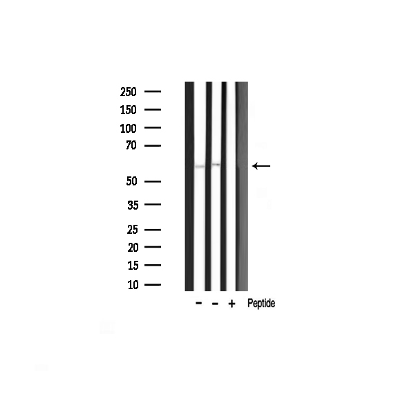 AKT1 Antibody - Western blot analysis of Akt1 phosphorylation expression in mouse lung and rat liver tissue lysates. The lane on the right is treated with the antigen-specific peptide.