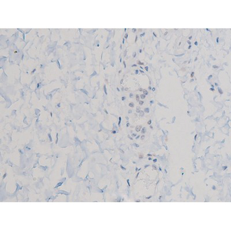 AKT1 Antibody - 1:200 staining human esophagus tissue by IHC-P. The tissue was formaldehyde fixed and a heat mediated antigen retrieval step in citrate buffer was performed. The tissue was then blocked and incubated with the antibody for 1.5 hours at 22°C. An HRP conjugated goat anti-rabbit antibody was used as the secondary.