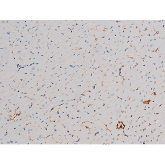 AKT1 Antibody - 1:200 staining mouse heart tissue by IHC-P. The tissue was formaldehyde fixed and a heat mediated antigen retrieval step in citrate buffer was performed. The tissue was then blocked and incubated with the antibody for 1.5 hours at 22°C. An HRP conjugated goat anti-rabbit antibody was used as the secondary.